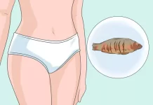 Неприятный запах из деликатной зоны: причины и лечение