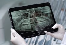 Стоматологический рентген: для чего он нужен?